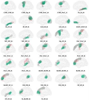 Clustering of Whole-Brain White Matter Short Association Bundles Using HARDI Data